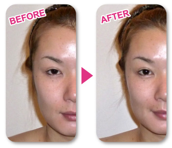 オルゴン造顔｜ファインメイク＆エステ Sweet pleasure[スウィート プレジャー]徳島