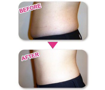 オルゴン造体｜ファインメイク＆エステ Sweet pleasure[スウィート プレジャー]徳島